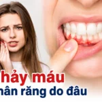 chay-mau-chan-rang-do-dau-nguyen-nhan-va-cach-xu-ly-dung