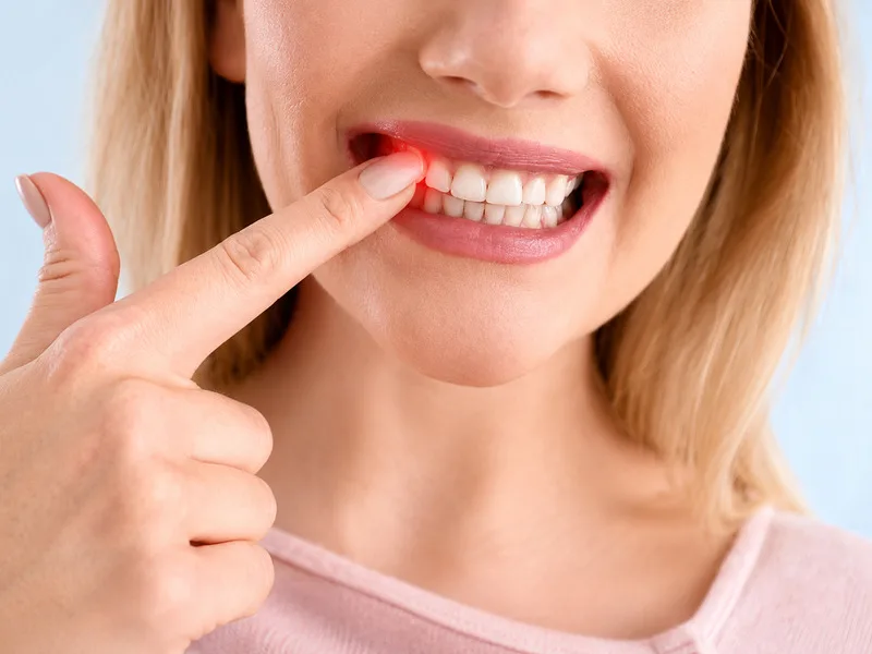 Một số loại thuốc và bệnh lý toàn thân có thể khiến nướu dễ chảy máu hoặc khó cầm máu.